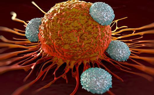 5 نشانه موذی ترین سرطان در بدن را بشناسید